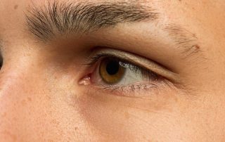 Dry Eye Prevention - Cornea & Cataract Consultants of Arizona