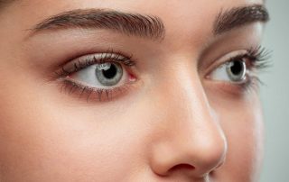 Proper eye care after a corneal transplant