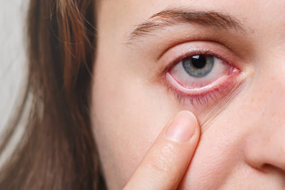 Dry Eye Syndrome Management - Cornea & Cataract Consultants of Arizona